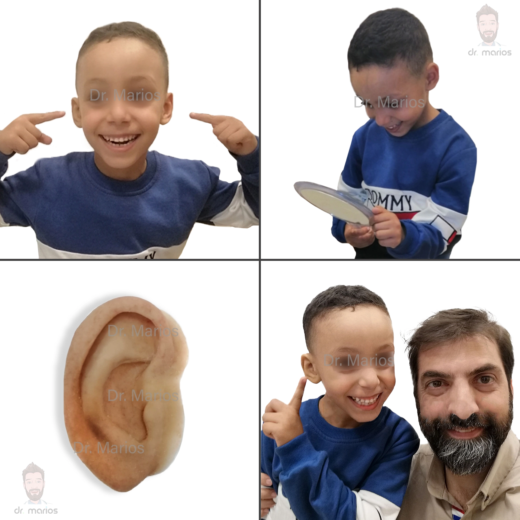 EarArtboard 2